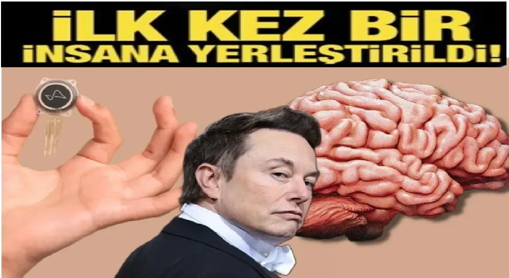 İlk Kez Bir İnsana Çip Takıldı!