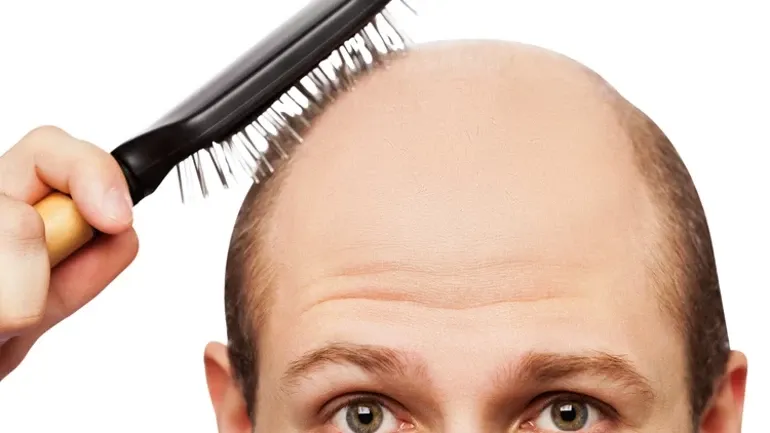 Kellik Sona mı  Eriyor ?